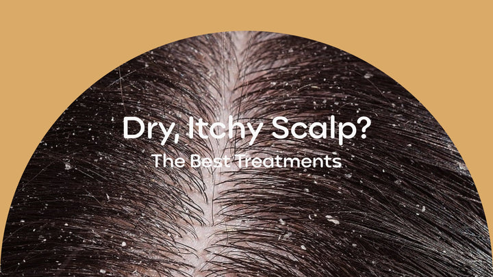 Dry, Itchy Scalp? The Best Treatments for Long-Lasting Relief